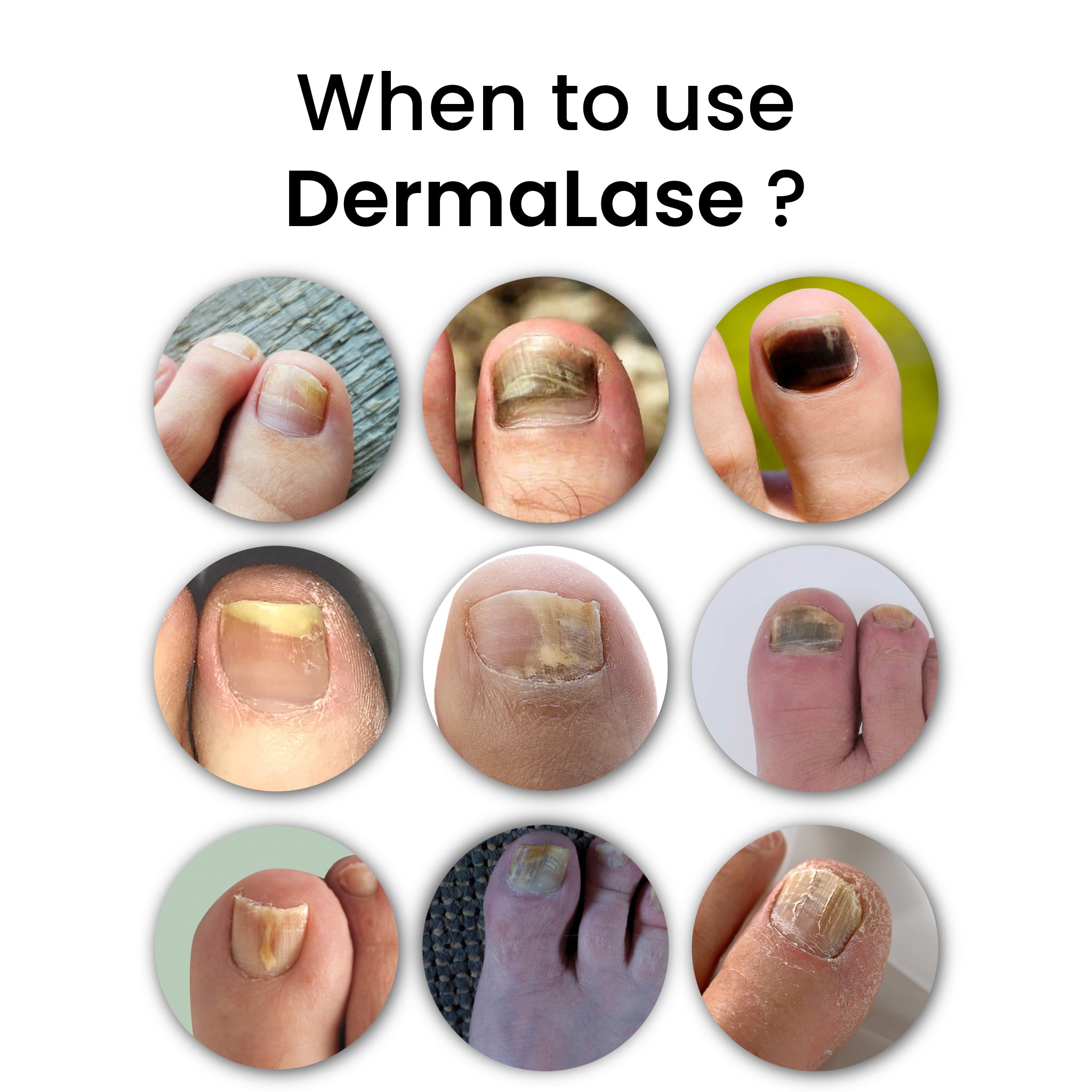 DermaLase (set)